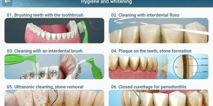 Dental 3D Illustrations